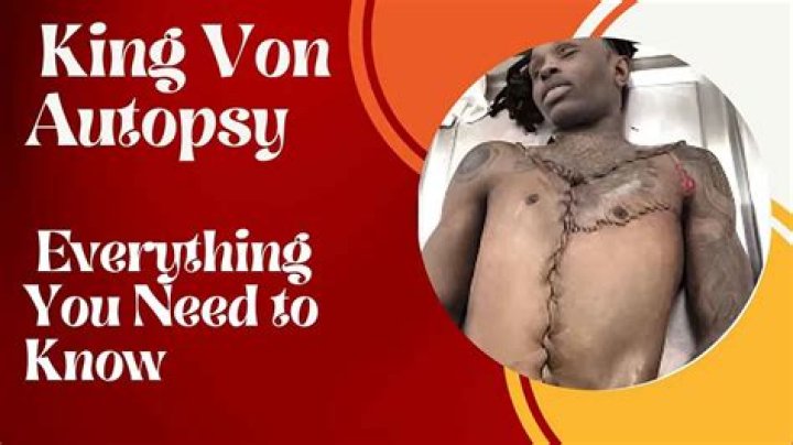 Uncovering The True Cause: King Face Autopsy Reveals Surprising Truth